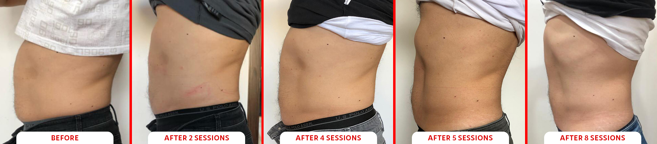 Tesla Former Abs Before and After