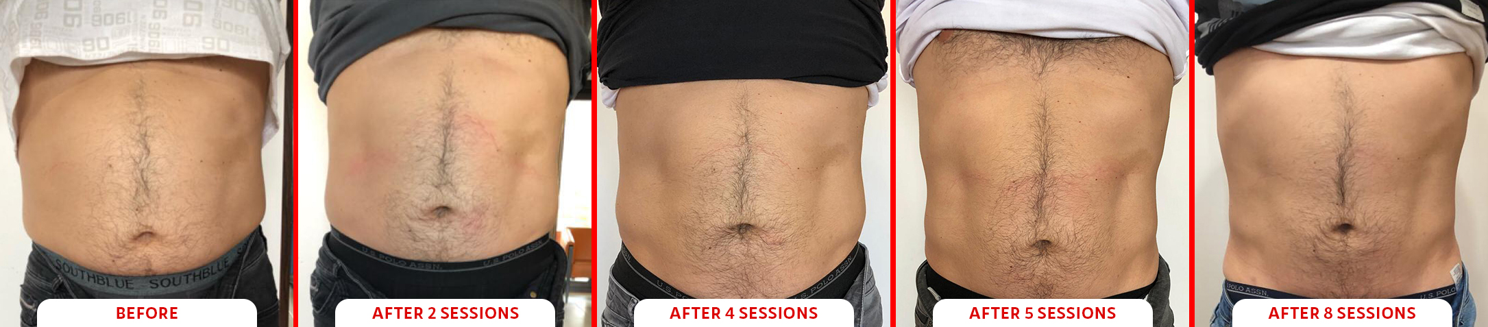 Tesla Former Abs Before and After